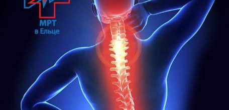 С 23 по 31 декабря в ДЦ «Импульс» скидка 30% на МРТ трёх отделов позвоночника