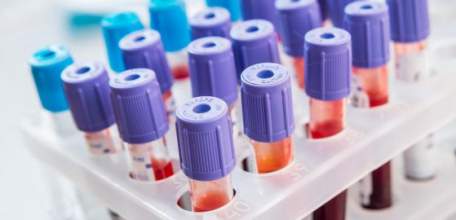 Коагулологические исследования крови в Клинике доктора Шаталова