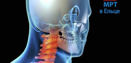 С 12 по 16 сентября в ДЦ «Импульс» скидка 30% на МРТ шейного отдела позвоночника
