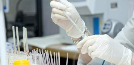 Анализ состояния инфекционной и паразитарной заболеваемости  в Липецкой области за январь-апрель 2019 года