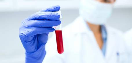В Клинике доктора Шаталова можно сдать анализ крови на ревматоидный фактор