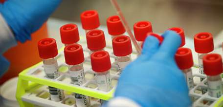 ФМБА России представило препарат для лечения коронавирусной инфекции