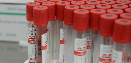 Инфицирование коронавирусом подтвердилось ещё у 21 человека в Липецкой области