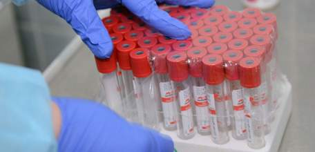 В Липецкой области - 21 новый случай заражения коронавирусом