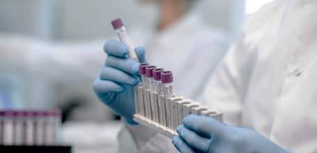 В Липецкой области коронавирусная инфекция подтвердилась ещё у 22 человек