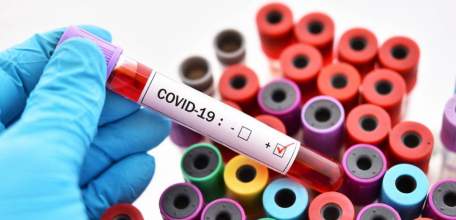 О проведенных исследованиях на новую коронавирусную инфекцию в Липецкой области по состоянию на 29.04.2020 г.