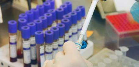 За минувшие сутки в Липецкой области коронавирусная инфекция подтвердилась у 46 человек