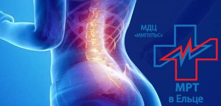 Акция в ДЦ «Импульс»: с 10 по 14 сентября МРТ пояснично-крестцового отдела позвоночника 2200 руб.