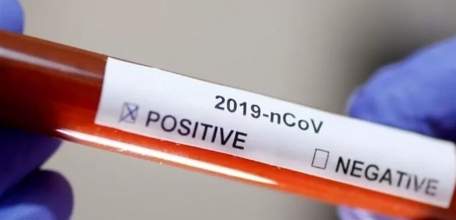 Что нужно делать, если вы узнали, что у вас коронавирус?