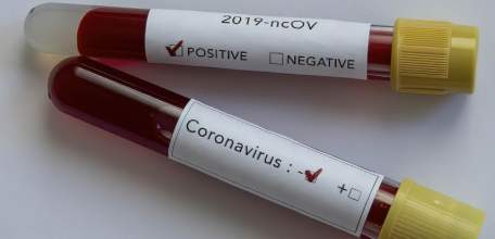 Сводка по коронавирусу в Липецкой области на 19 мая 2021 г.