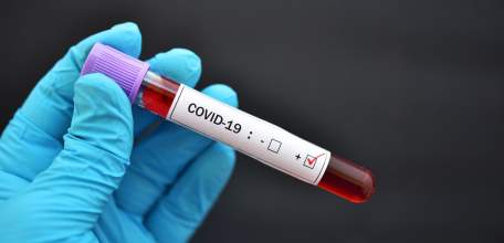 Сводка по коронавирусу в Липецкой области на 2 июня 2021 г.