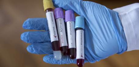 Сводка по коронавирусу в Липецкой области на 4 июня 2021 г.