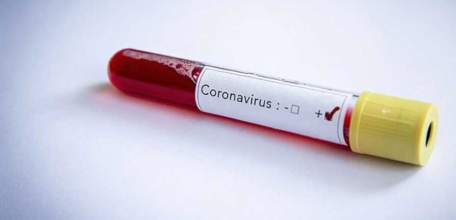 Сводка по коронавирусу в Липецкой области на 18 июля 2021 г.