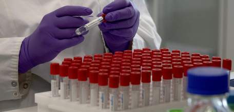 Сводка по коронавирусу в Липецкой области на 28 июля 2021 г.