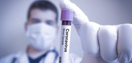 Сводка по коронавирусу в Липецкой области на 9 августа 2021 г.