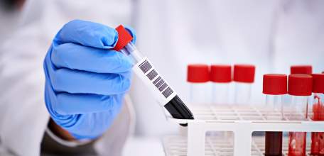 Сводка по коронавирусу в Липецкой области на 11 августа 2021 г.