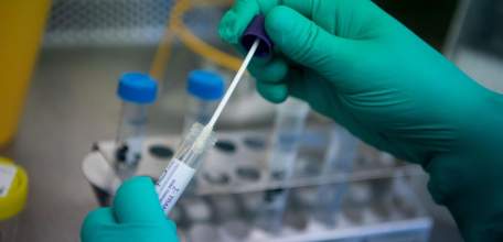 Сводка по коронавирусу в Липецкой области на 17 августа 2021 г.