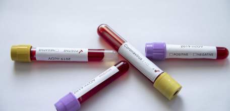 Сводка по коронавирусу в Липецкой области на 19 августа 2021 г.