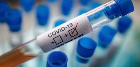 Сводка по коронавирусу в Липецкой области на 20 августа 2021 г.