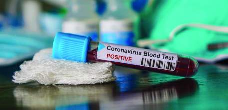 Сводка по коронавирусу в Липецкой области на 20 декабря 2021 г.