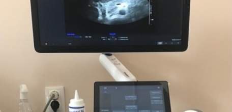 Более 3 тысяч обследований провели на новом УЗИ-аппарате в Елецкой городской детской больнице