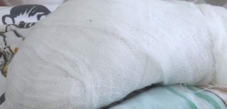 8 МУЖЧИН ГОСПИТАЛИЗИРОВАНЫ С ОБМОРОЖЕНИЯМИ В ПЕРВУЮ НЕДЕЛЮ ГОДА В ЛИПЕЦКЕ!