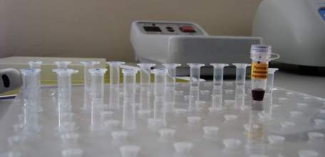 В Липецкой области зарегистрировано 11 случаев кори