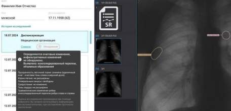 Искусственный интеллект поможет липецким врачам распознать 37 болезней