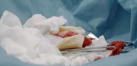 Задержан 19-летний ельчанин, подозреваемый в поножовщине в баре!