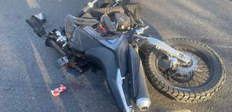 Два подростка в Липецкой области получили серьезные травмы в столкновении мотоцикла с легковушкой