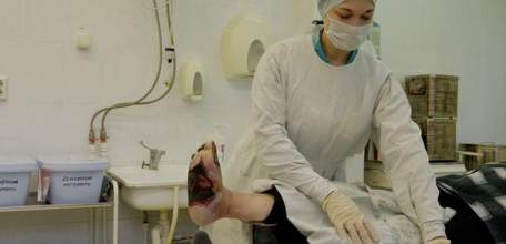 Пять домохозяек обварились кипятком в Липецкой области!