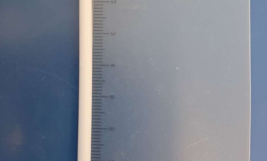 Происшествие произошло с 15-летним подростком, который проглотил палочку от чупа-чупс!