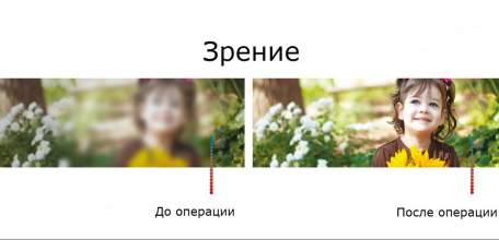 Уникальная акция в Клинике доктора Шаталова! Только в июне скидка 20 000 рублей на лазерную коррекцию зрения