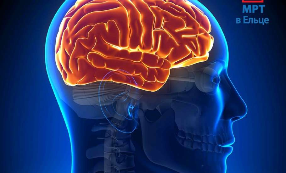 21-26 декабря в ДЦ «Импульс» скидка 30% на МРТ головного мозга